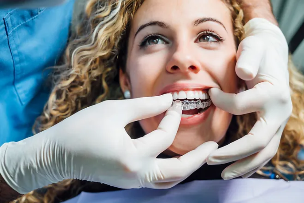 Aligneurs invisibles ou facettes dentaires : quelle solution pour un sourire parfait ?